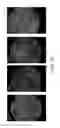 Fig. 17 - Optical lens fabrication