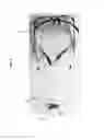 Fig. 09 - DEVICE FOR RAPID DETACHMENT OF EYEWEAR