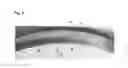 Fig. 03 - Molded Lens