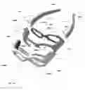 Fig. 22 - GLASSES FOR AMBLYOPIA TREATMENT
