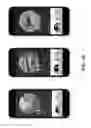 Fig. 45 - Mountable display devices