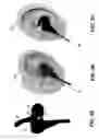 Fig. 05 - SYSTEM AND METHOD FOR PROVIDING LIFESTYLE RECOMMENDATIONS USING EARPHONES WITH BIOMETRIC SENSORS