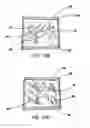 Fig. 12 - Simulated dissectible tissue
