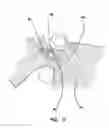 Fig. 14 - Simulated dissectible tissue