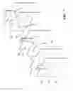 Fig. 07 - ROBUST PIEZOELECTRIC FLUID MOVING DEVICES AND METHODS