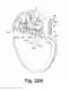 Fig. 24 - Down the bore with open windows and manufacturing thereof