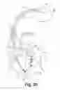 Fig. 29 - Down the bore with open windows and manufacturing thereof