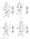Fig. 40 - Flexible resonator attachment