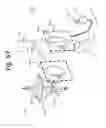 Fig. 81 - Flexible resonator attachment