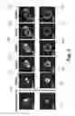 Fig. 07 - Adaptive optics based simultaneous turbulence compensation of multiple orbital angular momentum beams