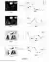 Fig. 20 - EXPOSURE CONTROL FOR AN IMAGING SYSTEM