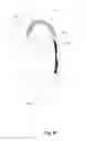 Fig. 16 - Wearable apparatus securable to clothing