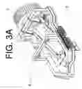 Fig. 05 - Detachable Transportable Rock Picker