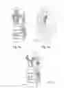 Fig. 05 - CONTROL SYSYTEM FOR MOTOR-DRIVEN LAWNMOWER VEHICLE
