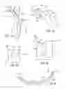 Fig. 06 - Strapping system for agricultural implement