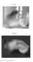 Fig. 04 - METHOD FOR CONTROLLING LASIODERMA SERRICORNE USING ANISOPTEROMALUS APIOVORUS