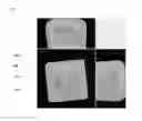 Fig. 02 - Transparent and transluscent liquid filled candy; process of making thereof; sugar-free liquid edible composition; and use thereof