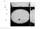 Fig. 05 - Transparent and transluscent liquid filled candy; process of making thereof; sugar-free liquid edible composition; and use thereof