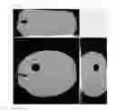 Fig. 07 - Transparent and transluscent liquid filled candy; process of making thereof; sugar-free liquid edible composition; and use thereof