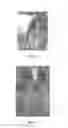 Fig. 06 - RICING SYSTEM WITH SLOTTED RICER PLATE AND METHOD