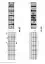 Fig. 11 - Microwave sterilization or pasteurization