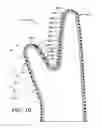 Fig. 09 - PROTECTIVE ARTICLE WITH FLEXIBLE PROTECTIVE PADS