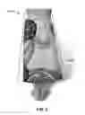 Fig. 06 - Combination beach towel and cover-up