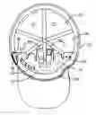 Fig. 01 - Insert to hold articles in a cap