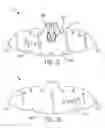 Fig. 08 - Insert to hold articles in a cap