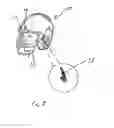 Fig. 08 - Helmet for reducing concussive forces during collision and facilitating rapid facemask removal