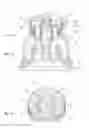 Fig. 03 - Connection device between a distributor head and a cosmetic product applicator, head comprising such a device, tube comprising such a head and associated applicator