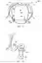 Fig. 06 - Compression system for backpack