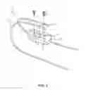 Fig. 04 - Lid holding device
