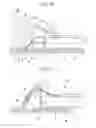 Fig. 07 - Treatment tool for endoscope