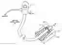 Fig. 01 - Medical scope attachment device and system