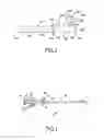 Fig. 02 - CYSTOSCOPIC DEVICE AND METHODS FOR OPERATING SAME