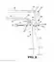 Fig. 05 - VAGINAL SPECULUM