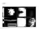 Fig. 06 - OPTICAL COHERENCE TOMOGRAPHY APPARATUS AND FUNDUS IMAGE PROCESSING PROGRAM