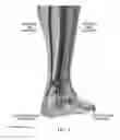 Fig. 05 - METHOD AND SYSTEM FOR ASSESSING SEVERITY AND STAGE OF PERIPHERAL ARTERIAL DISEASE AND LOWER EXTREMITY WOUNDS USING ANGIOSOME MAPPING