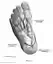 Fig. 06 - METHOD AND SYSTEM FOR ASSESSING SEVERITY AND STAGE OF PERIPHERAL ARTERIAL DISEASE AND LOWER EXTREMITY WOUNDS USING ANGIOSOME MAPPING