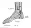Fig. 07 - METHOD AND SYSTEM FOR ASSESSING SEVERITY AND STAGE OF PERIPHERAL ARTERIAL DISEASE AND LOWER EXTREMITY WOUNDS USING ANGIOSOME MAPPING