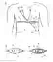Fig. 01 - PHYSIOLOGIC MONITORING SYSTEMS AND METHODS