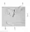Fig. 12 - ECG patch and methods of use