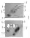 Fig. 20 - ECG patch and methods of use