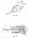 Fig. 08 - Catheter assembly