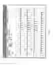 Fig. 03 - Electrocardiograph display by anatomical structure