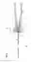 Fig. 03 - Bioimpedance sensor, stylet, cannula and method for measuring bioimpedance