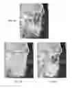 Fig. 09 - Method and system for analyzing craniofacial complex images