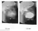 Fig. 10 - Method and system for analyzing craniofacial complex images