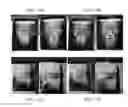 Fig. 14 - Method and system for analyzing craniofacial complex images